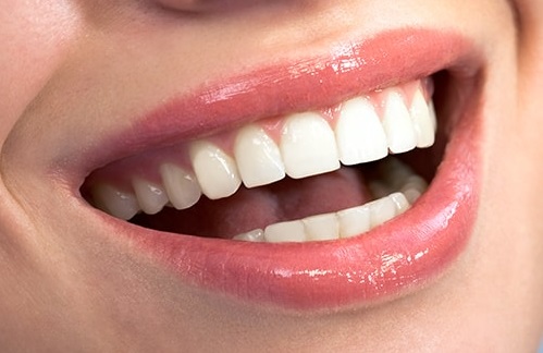 Laser Crown Lengthening Procedures